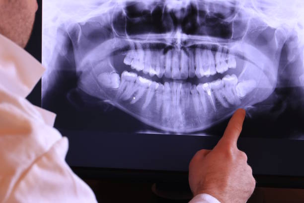 Best Weekend Emergency Dentist in Marshfield, WI