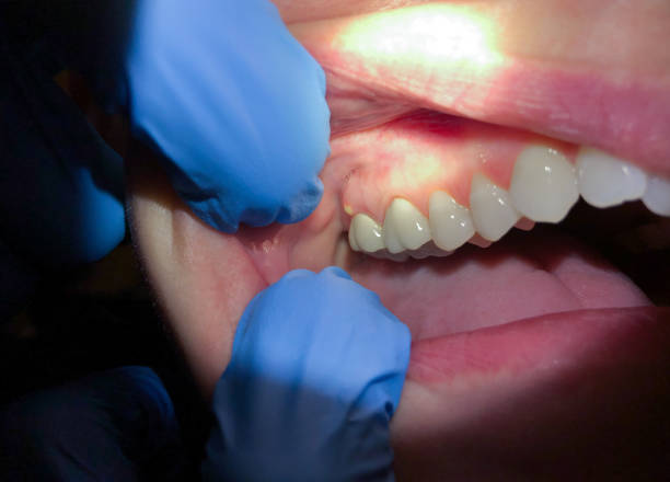 Best Cosmetic Emergency Dentistry in Marshfield, WI