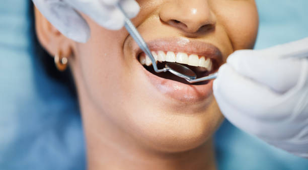 Best Emergency Dental Care for Broken or Chipped Teeth in Marshfield, WI