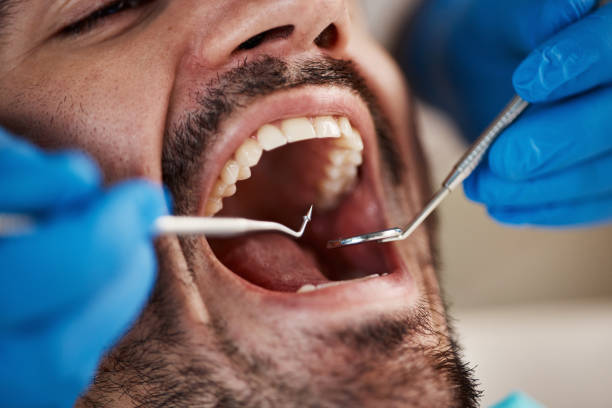 Best Same-Day Emergency Dental Services in Marshfield, WI